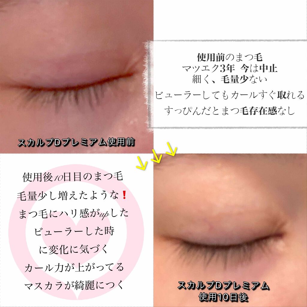 スカルプD ボーテ ピュアフリーアイラッシュセラム プレミアム/アンファー(スカルプD)/まつげ美容液を使ったクチコミ(2枚目)