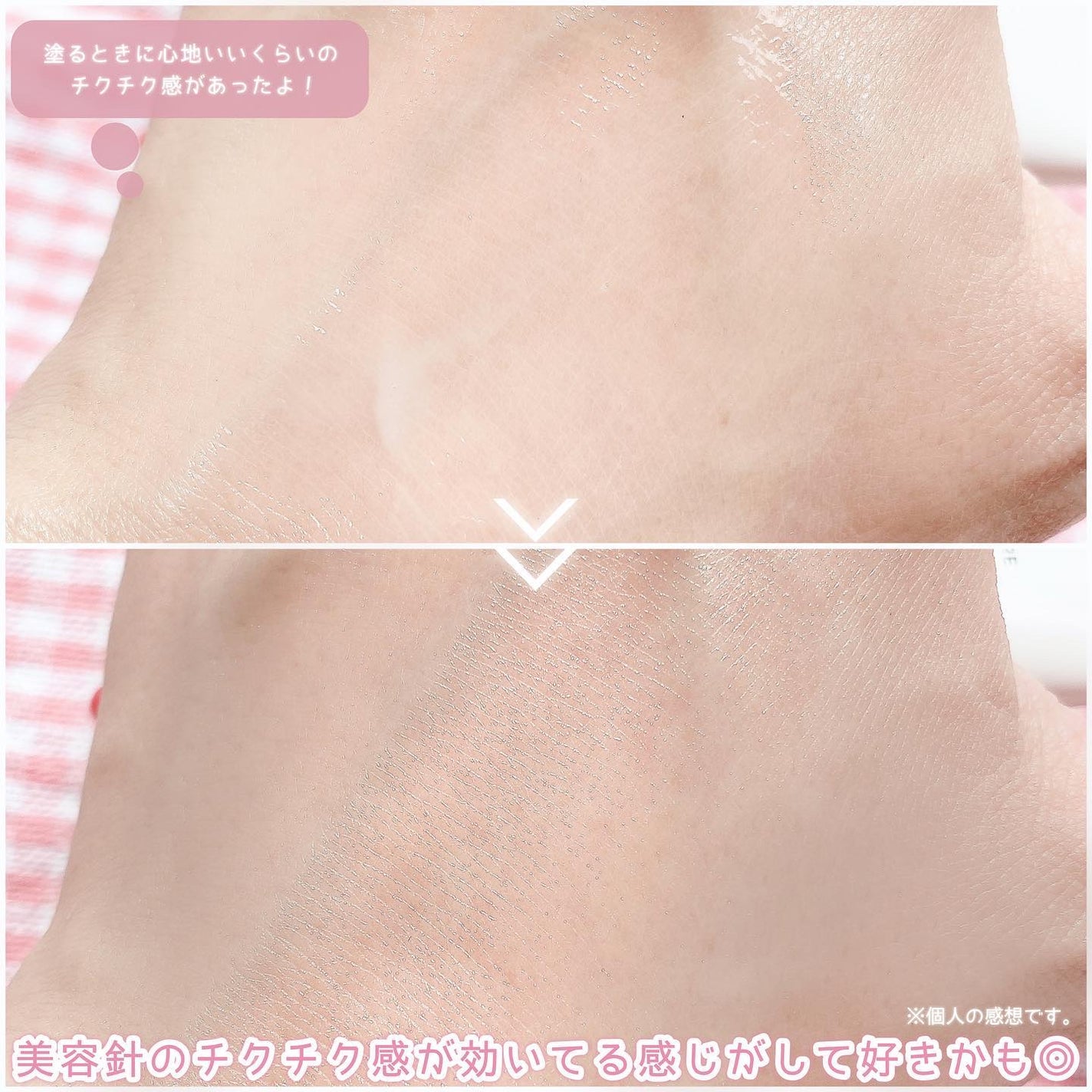 エーキュアスピキュールスポット/obsero/フェイスクリームを使ったクチコミ(6枚目)