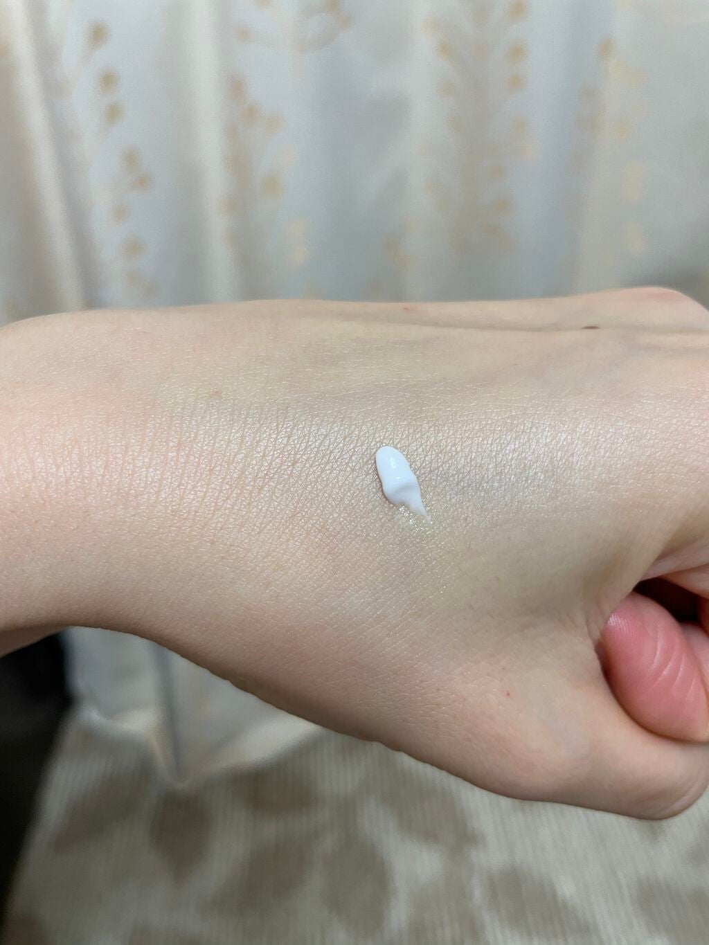 マキロン アクネージュ メディカルクリーム (医薬品) /マキロン/その他を使ったクチコミ(2枚目)