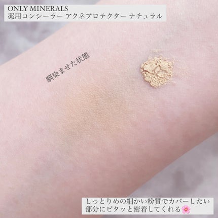 薬用コンシーラー アクネプロテクター/ONLY MINERALS/パウダーコンシーラーを使ったクチコミ(3枚目)