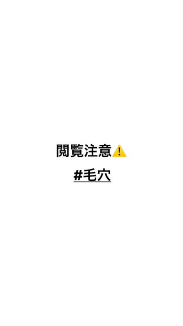 オードムーゲ オードムーゲ 薬用ローション（ふきとり化粧水）のクチコミ「このブツブツ冬までに治したいです！！！
誰か助けてください！！アドバイスお願いします🙇‍♀️
.....」（1枚目）