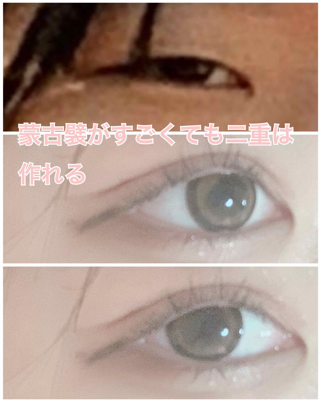 のびーるアイテープ（絆創膏タイプ、レギュラー）/DAISO/二重まぶた用アイテムを使ったクチコミ（1枚目）