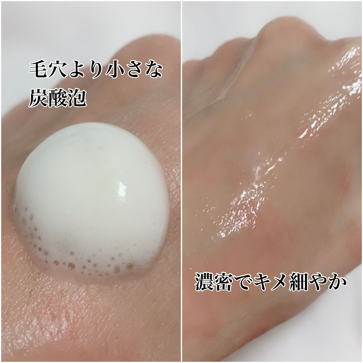 センサイ AS マイクロ ムース トリートメント s/SENSAI/化粧水を使ったクチコミ(5枚目)