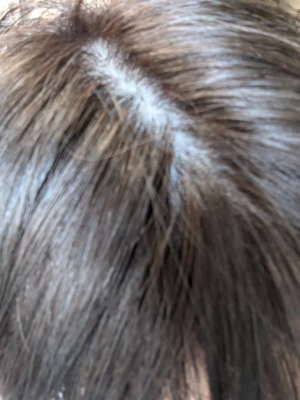 泡カラー/リーゼ/ヘアカラーを使ったクチコミ(10枚目)