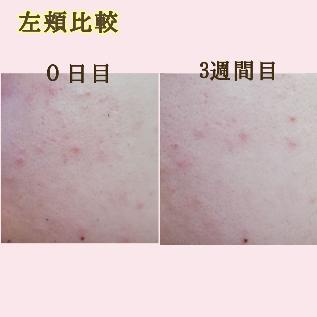 ザ・タイムR アクア/IPSA/化粧水を使ったクチコミ（2枚目）