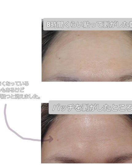 リンクルリペアしわパッチ/MARSHIQUE/その他スキンケアを使ったクチコミ(7枚目)