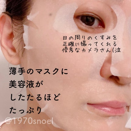 ダーマレーザースーパーVC100マスク/クオリティファースト/シートマスク・パックを使ったクチコミ(4枚目)