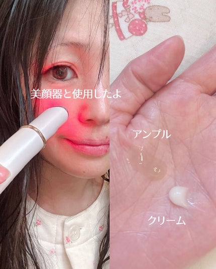 ハイニカルディープティングアンプル/KOPHER/美容液を使ったクチコミ(5枚目)