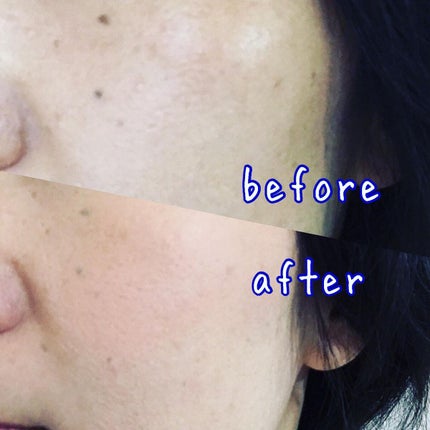 タトゥーウォータープルーフスカーコンシーラー/フォレンコス/リキッドコンシーラーを使ったクチコミ(8枚目)