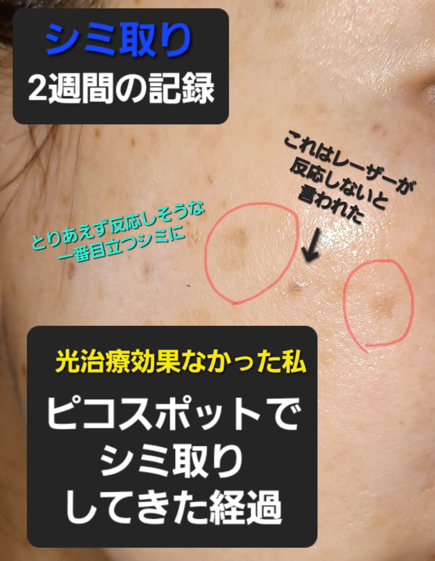 VC100エッセンスローション EX/ドクターシーラボⓇ/化粧水を使ったクチコミ（1枚目）