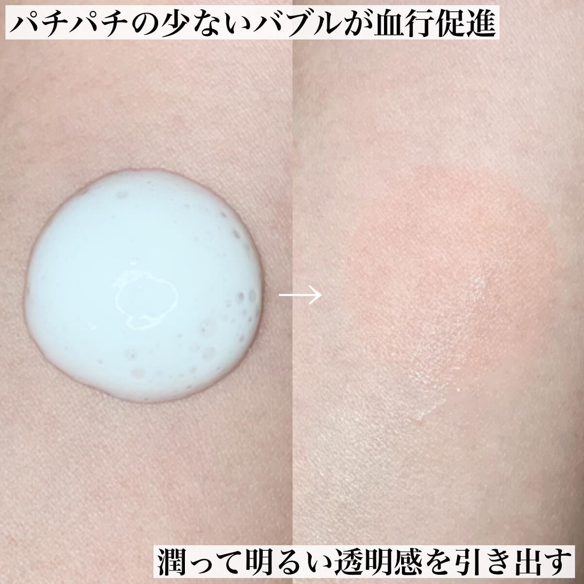 薬用ファーストエッセンス/ALBLANC/ブースター・導入液を使ったクチコミ(4枚目)