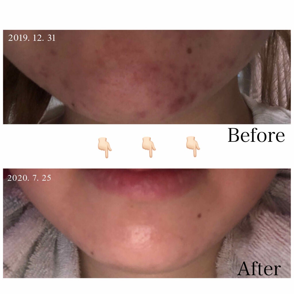 クリアウォッシュ/オルビス/洗顔フォームを使ったクチコミ(1枚目)