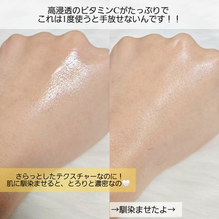 VC100エッセンスローション EX/ドクターシーラボⓇ/化粧水を使ったクチコミ(4枚目)