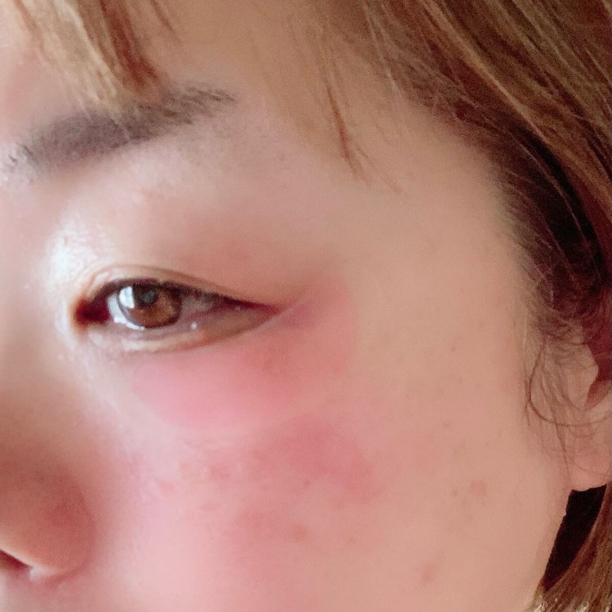 ステムトリートメント ニードルセラム/Reinca/シートマスク・パックを使ったクチコミ(3枚目)