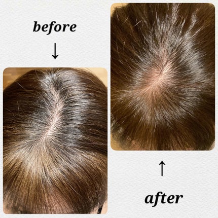 泡クリームカラー/ビゲン/ヘアカラーを使ったクチコミ(5枚目)