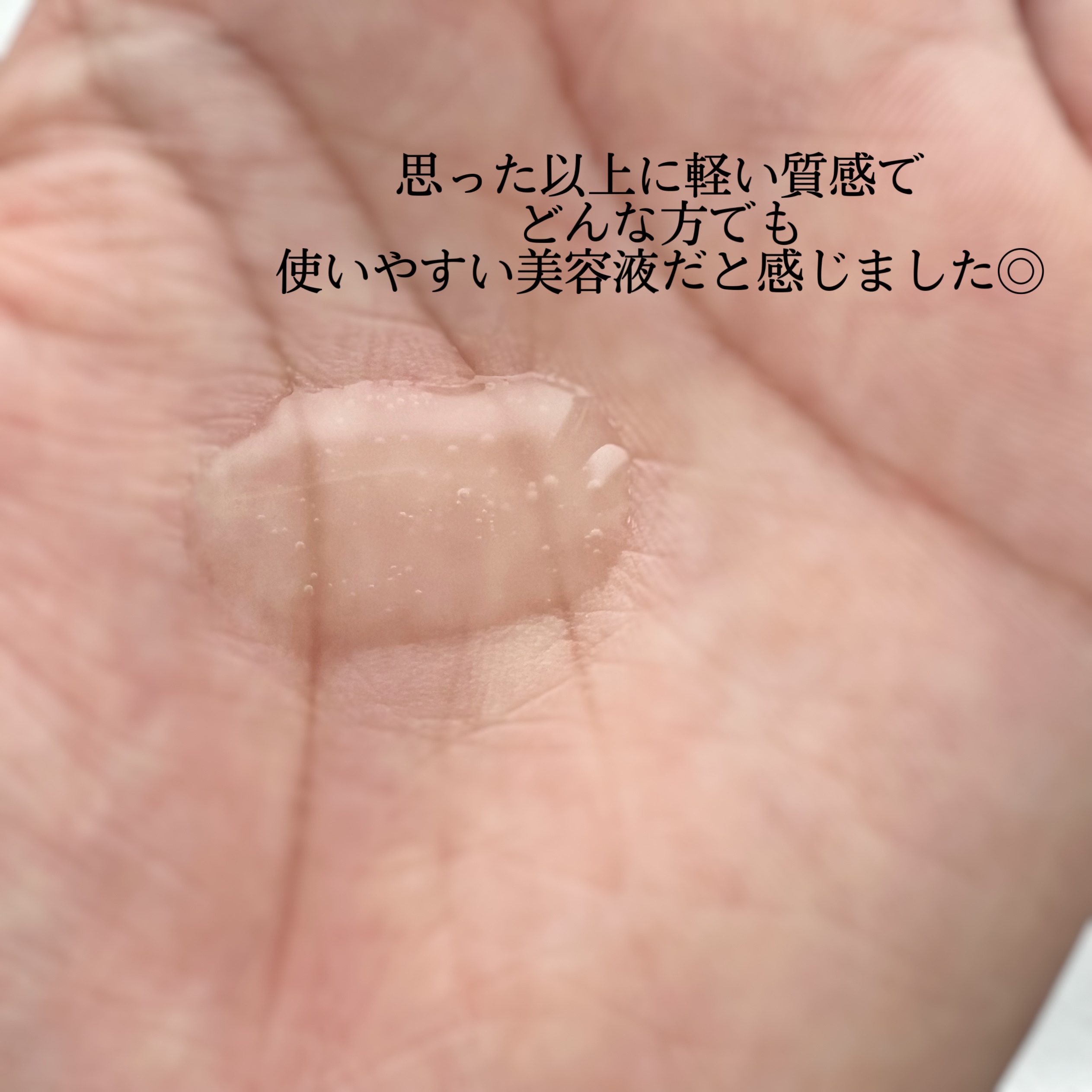 モイストケア ローション MB/d プログラム/化粧水を使ったクチコミ（3枚目）