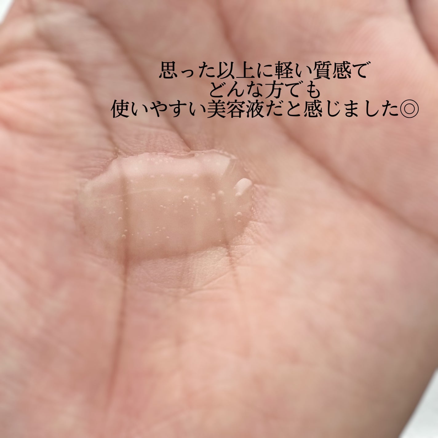 モイストケア ローション MB/d プログラム/化粧水を使ったクチコミ(3枚目)