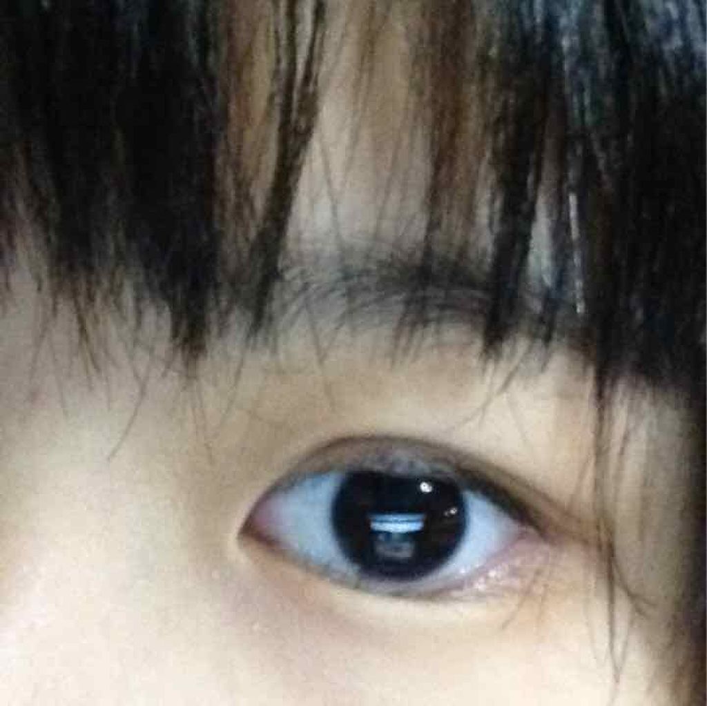 モアリップ N (医薬品)/資生堂薬品/その他を使ったクチコミ（3枚目）