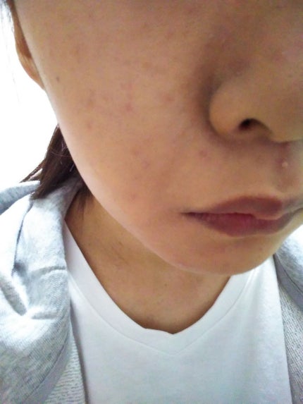 フィットミーリキッドファンデーション/MAYBELLINE NEW YORK/リキッドファンデーションを使ったクチコミ(3枚目)