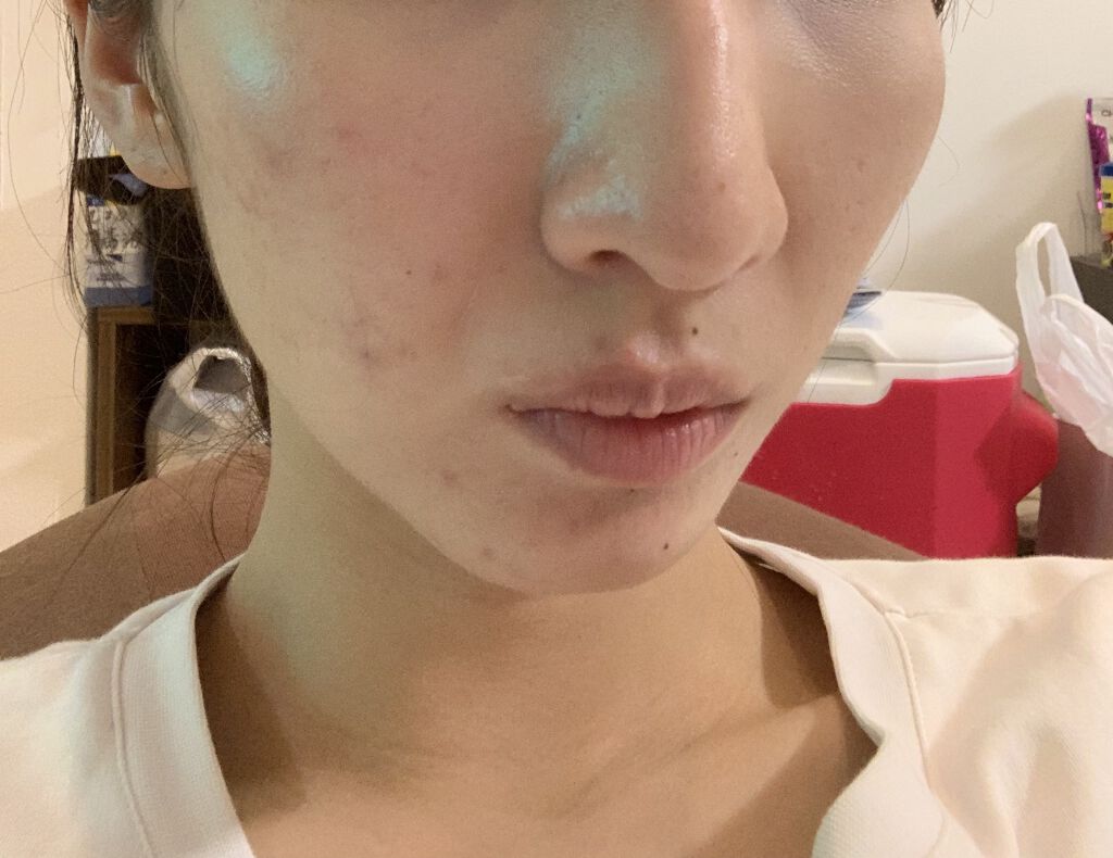 VC100エッセンスローション EX/ドクターシーラボⓇ/化粧水を使ったクチコミ（2枚目）