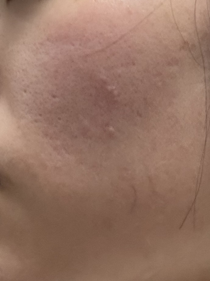 キス マットシフォン UVハイカバーベース/KiSS/化粧下地を使ったクチコミ（3枚目）