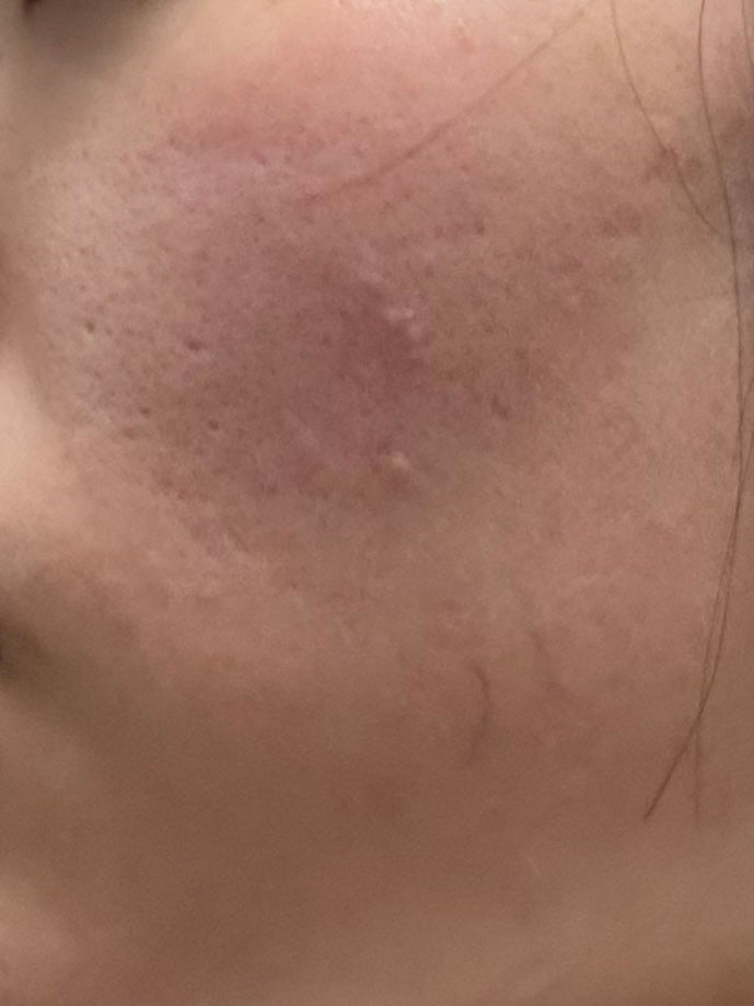 キス マットシフォン UVハイカバーベース/KiSS/化粧下地を使ったクチコミ(3枚目)