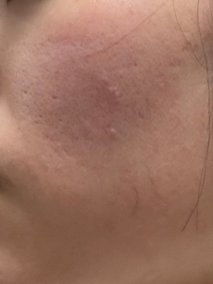 キス マットシフォン UVハイカバーベース/KiSS/化粧下地を使ったクチコミ(3枚目)