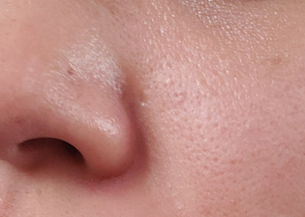 AHA 30% + BHA 2% Peeling Solution/The Ordinary/ピーリングを使ったクチコミ（3枚目）