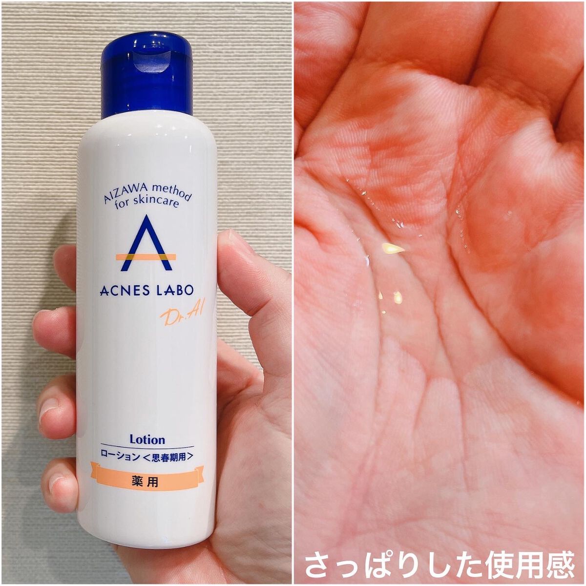 薬用ニキビケア ウォッシングフォーム(思春期用)/アクネスラボ/洗顔フォームを使ったクチコミ(3枚目)