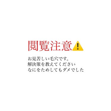 くっきー on LIPS 「もう何年も悩んでいて皮膚科にも通いましたが治る気配はありません..」（1枚目）