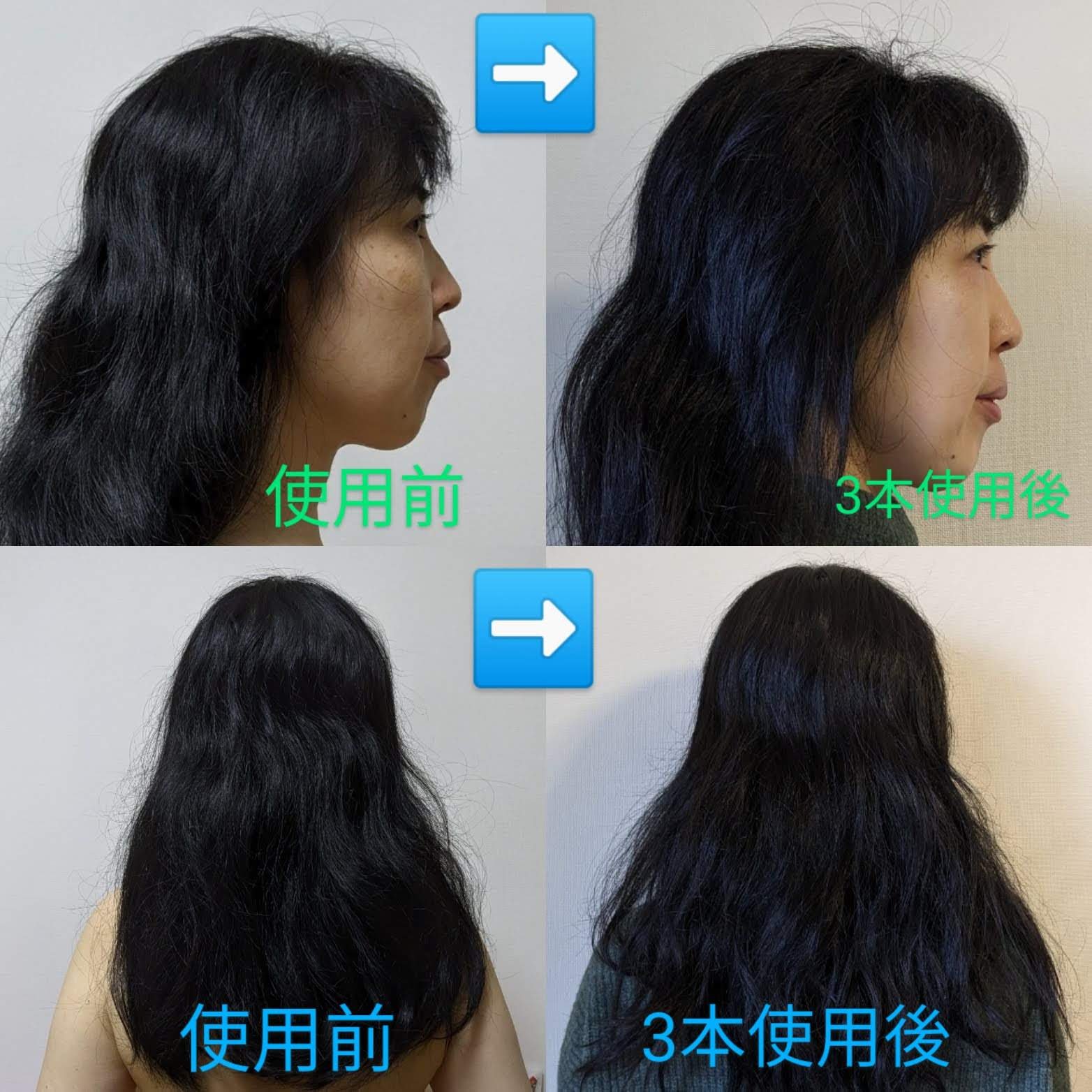 スパークリングスカルプスケーラー/ミンツリー/頭皮ケアを使ったクチコミ（3枚目）