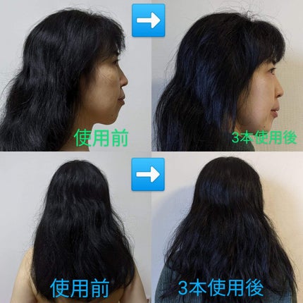 スパークリングスカルプスケーラー/ミンツリー/頭皮ケアを使ったクチコミ(3枚目)