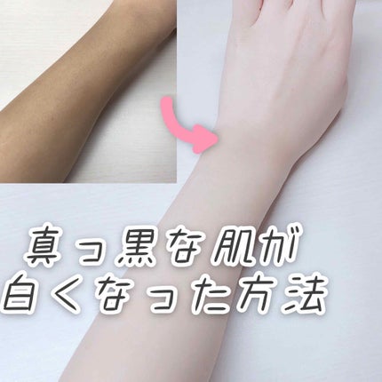 ハトムギ化粧水(ナチュリエ スキンコンディショナー R )/ナチュリエ/化粧水を使ったクチコミ(1枚目)