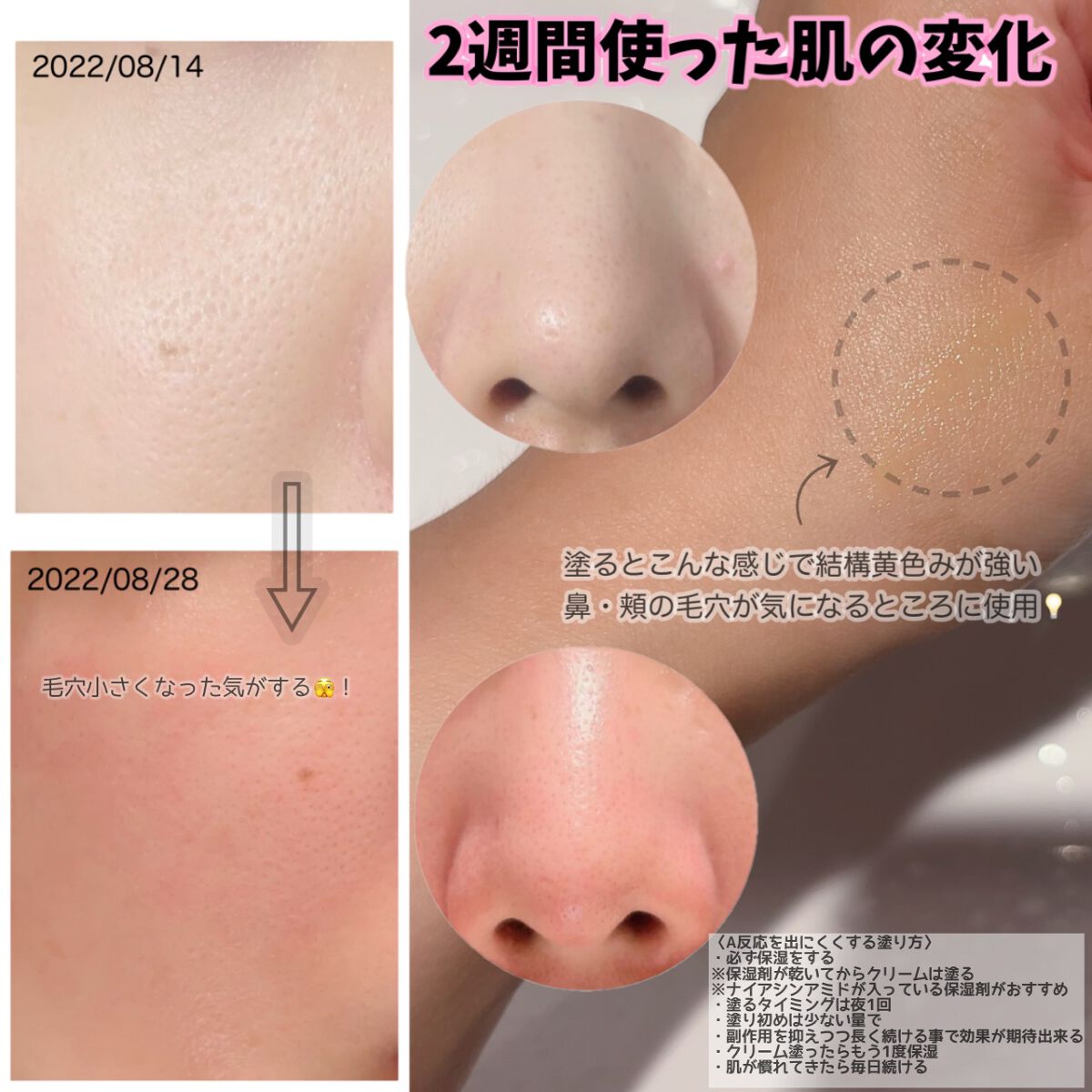 リンクルビタAスポットプロ/ネイチャーリパブリック/美容液を使ったクチコミ（3枚目）