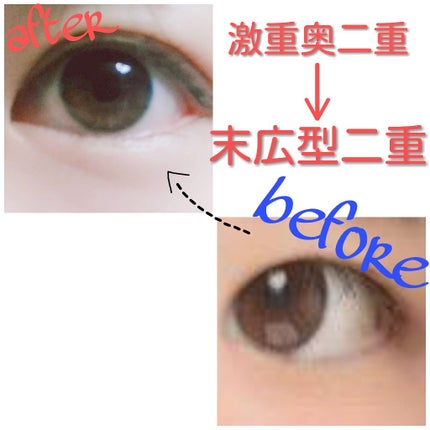 ã¢ã€ããŒãïŒçµåµèã¿ã€ããã¬ã®ã¥ã©ãŒãïŒïŒæïŒ/DAISO/äºéãŸã¶ãçšã¢ã€ãã ã䜿ã£ãã¯ãã³ãïŒ1æç®ïŒ