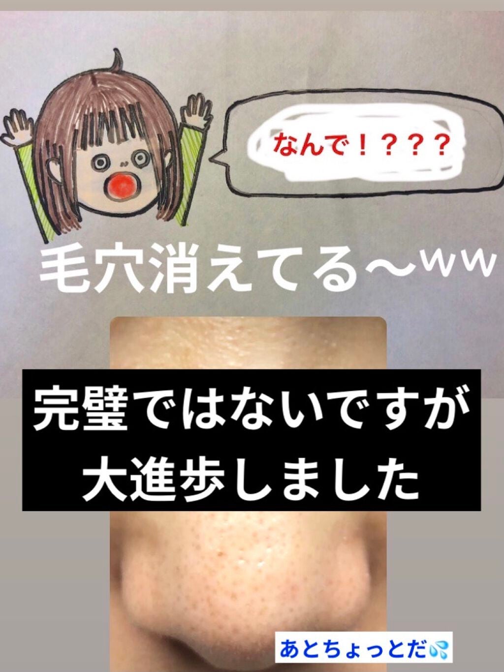 オリジナル ピュアスキンジェリー/ヴァセリン/ボディクリームを使ったクチコミ(1枚目)