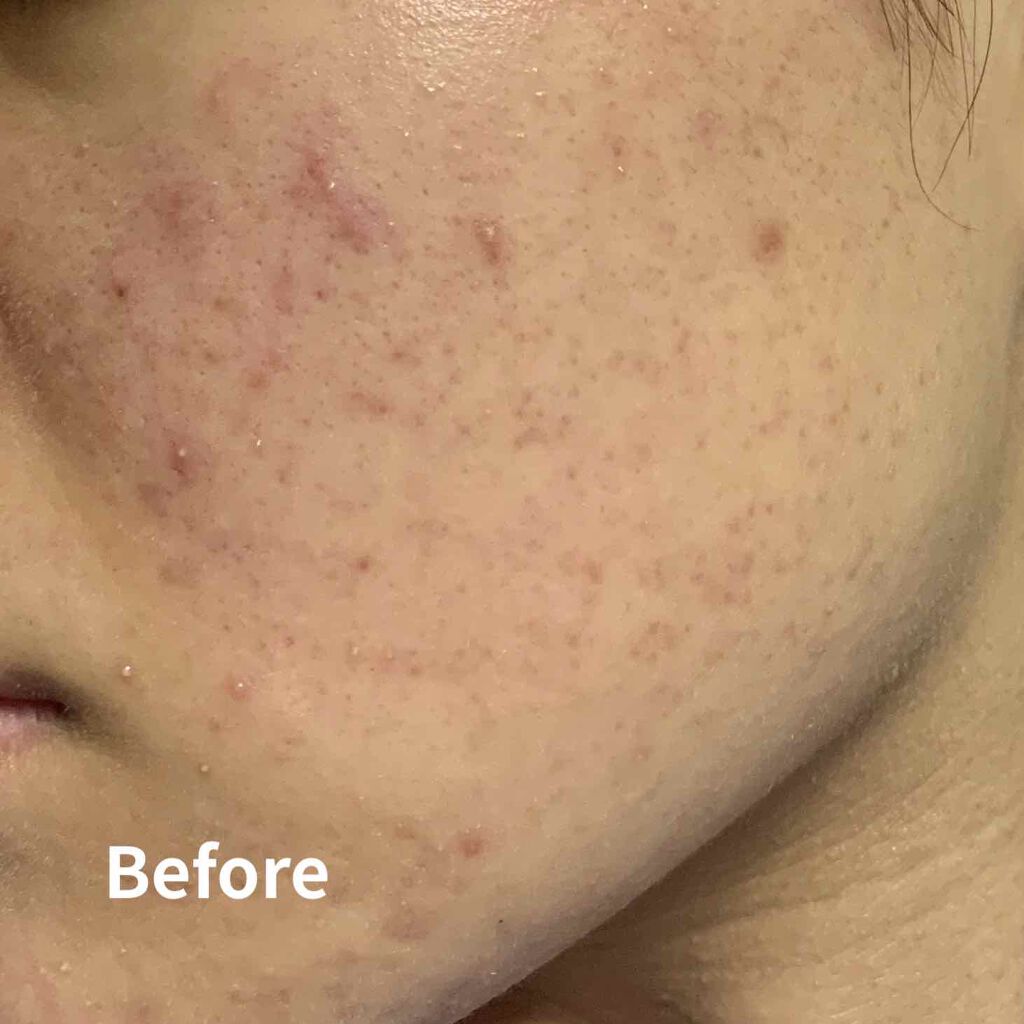 白色ワセリン(医薬品)/健栄製薬/その他を使ったクチコミ(2枚目)