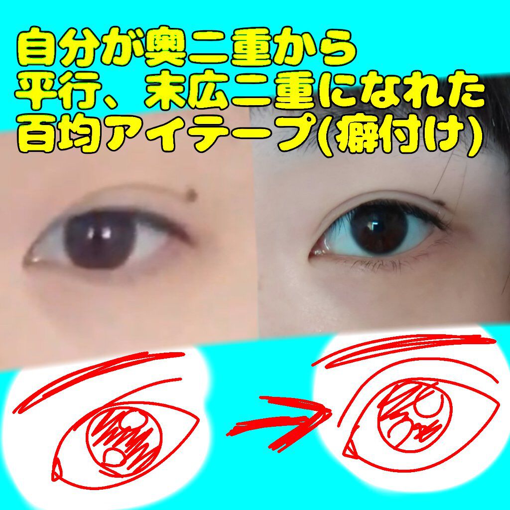 理想のふたえ ぱっちり幅広 ヌーディーワイド/セリア/二重まぶた用アイテムを使ったクチコミ(1枚目)