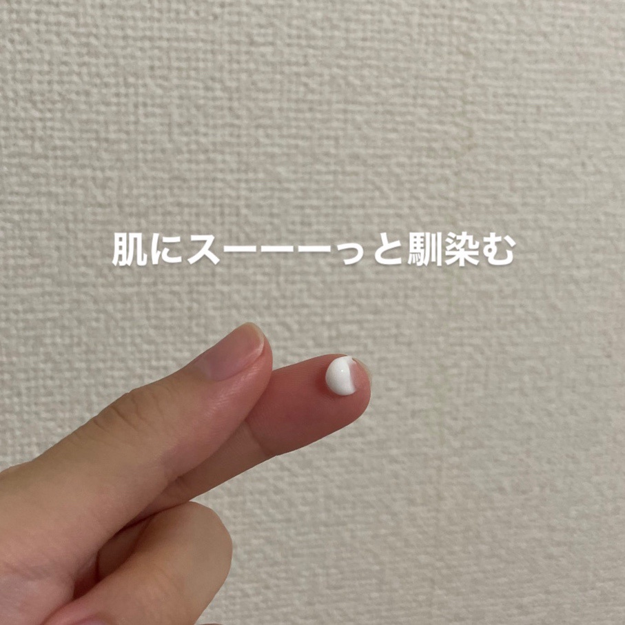 アクネキュアクリーム(医薬品)/IHADA/その他を使ったクチコミ（2枚目）