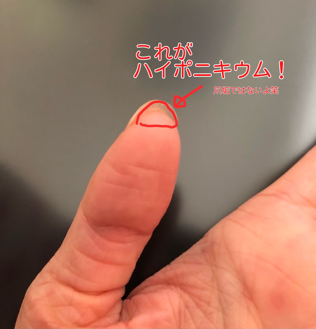 エテュセ クイックケアコート/ettusais/ネイルオイル・トリートメントを使ったクチコミ（3枚目）