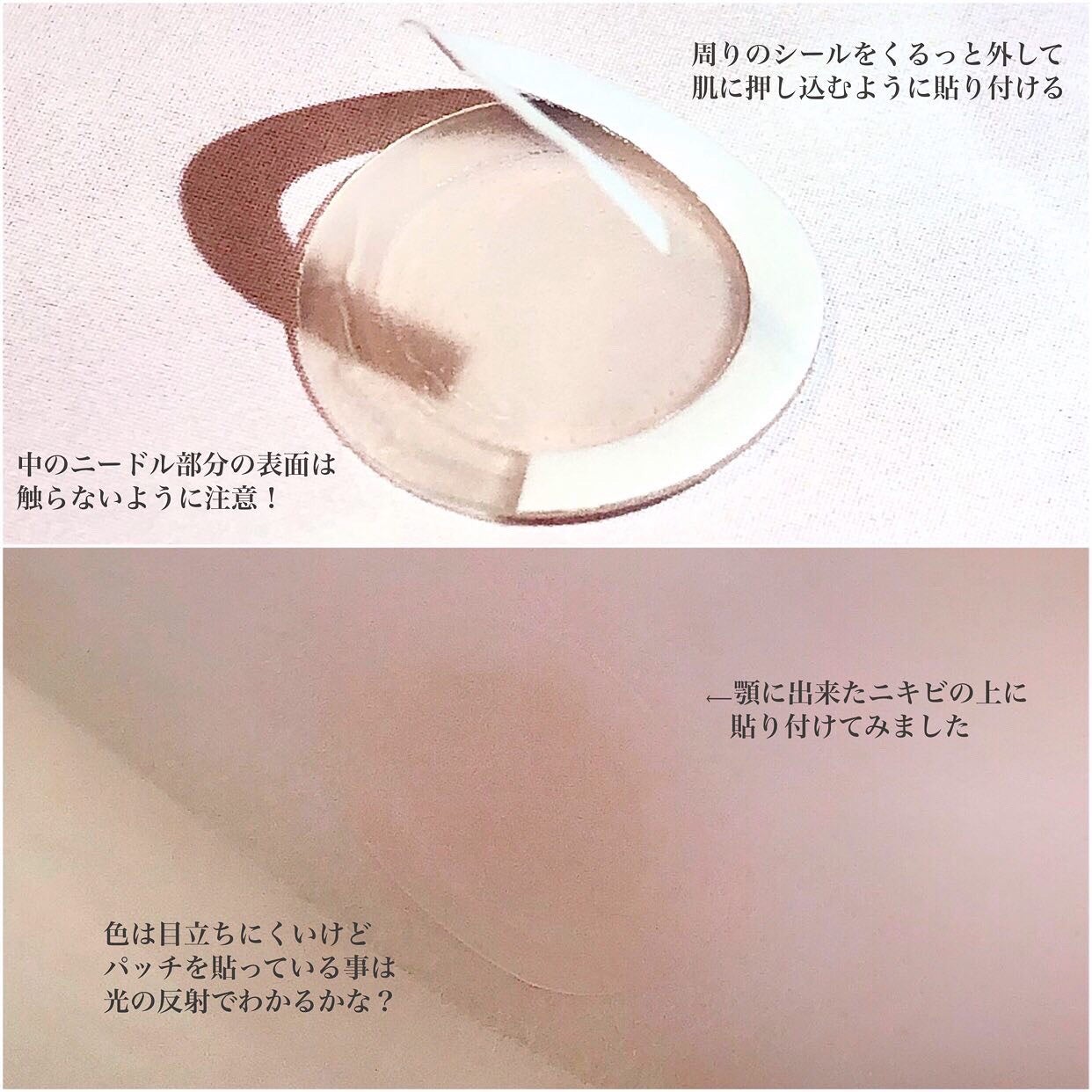 エーキュアショットスポットパッチ/obsero/にきびパッチを使ったクチコミ(3枚目)