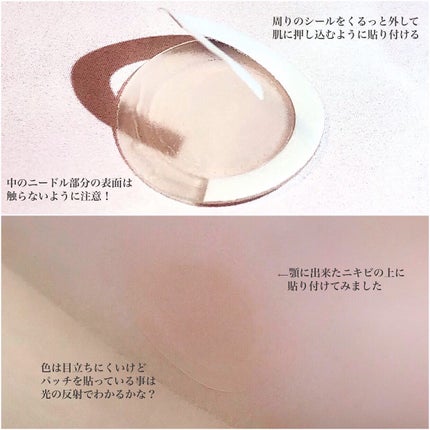 エーキュアショットスポットパッチ/obsero/にきびパッチを使ったクチコミ(3枚目)