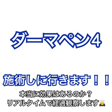 たそ on LIPS 「⚠️閲覧注意⚠️流行りのダーマペン4を施術しに行きます！（とい..」（1枚目）