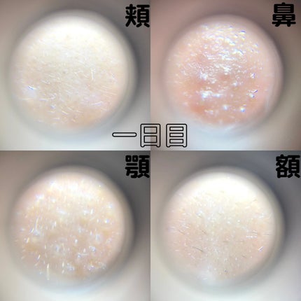 VITALIFT A forte/Dr.Different/フェイスクリームを使ったクチコミ(7枚目)