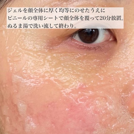 炭酸ジェルパック/NANO ACQUA/洗い流すパック・マスクを使ったクチコミ(6枚目)