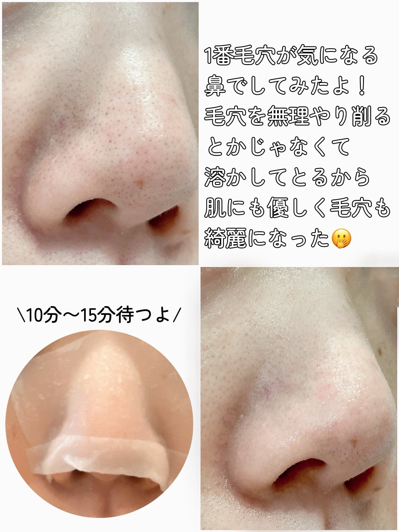 ディープクリーンマスター/ilso/その他スキンケアグッズを使ったクチコミ(4枚目)