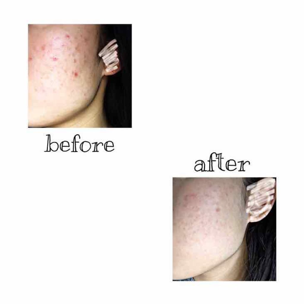 明色美顔水 薬用化粧水/美顔/化粧水を使ったクチコミ（2枚目）