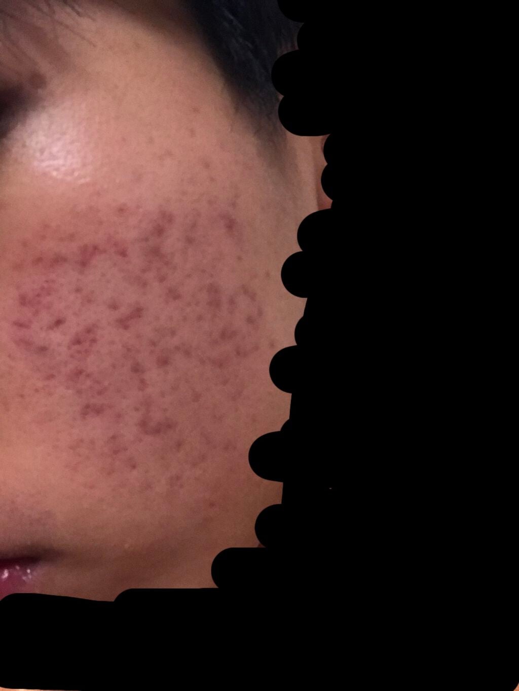 薬用 しみ 集中対策 美容液/メラノCC/美容液を使ったクチコミ(1枚目)