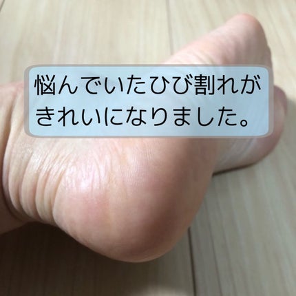 かかとちゃん/桐灰化学/レッグ・フットケアを使ったクチコミ(2枚目)