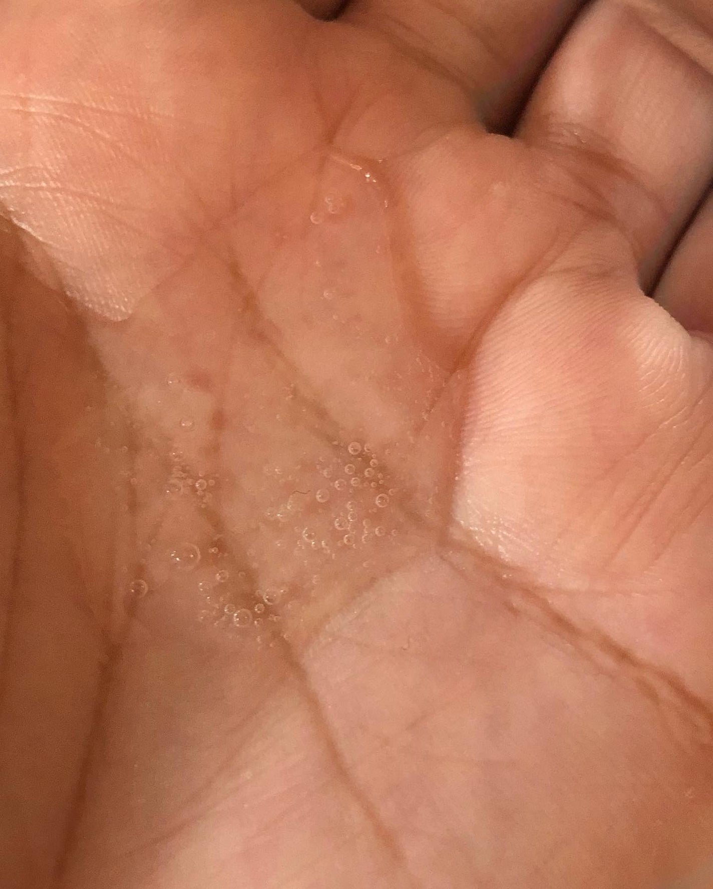 ドレススノー ローション【医薬部外品】 /アテニア/化粧水を使ったクチコミ(4枚目)